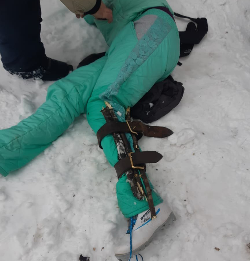 В Татарстане спасатели помогли лыжнице, сломавшей ногу во время прогулки